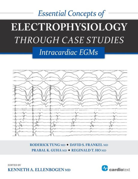 Essential Concepts of Electrophysiology Through Case Studies: Intracardiac EGMs : Intracardiac EGMs