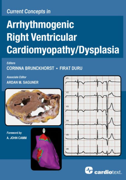 Current Concepts in Arrhythmogenic Right Ventricular Cardiomyopathy/Dysplasia