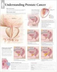 Title: Understanding Prostate Cancer Wall Chart, Author: Various