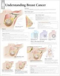 Title: Understanding Breast Cancer Wall Chart, Author: Various