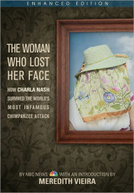Title: The Woman Who Lost Her Face: How Charla Nash Survived the World's Most Infamous Chimpanzee Attack (Enhanced Edition), Author: NBC News