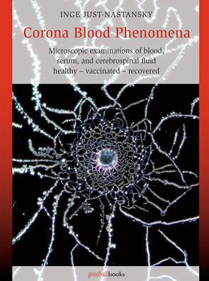 Corona Blood Phenomena: Microscopic Examinations of Blood, Serum, and Cerebrospinal Fluid: Healthy - Vaccinated - Recovered