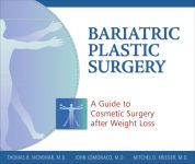 Alternative view 1 of Bariatric Plastic Surgery: A Guide to Cosmetic Surgery After Weight Loss