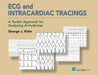 Title: ECG and Intracardiac Tracings: A Toolkit Approach for Analyzing Arrhythmias, Author: George J. Klein