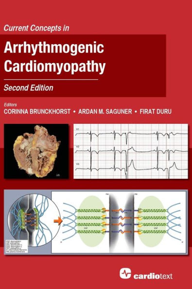Current Concepts Arrhythmogenic Cardiomyopathy, Second Edition