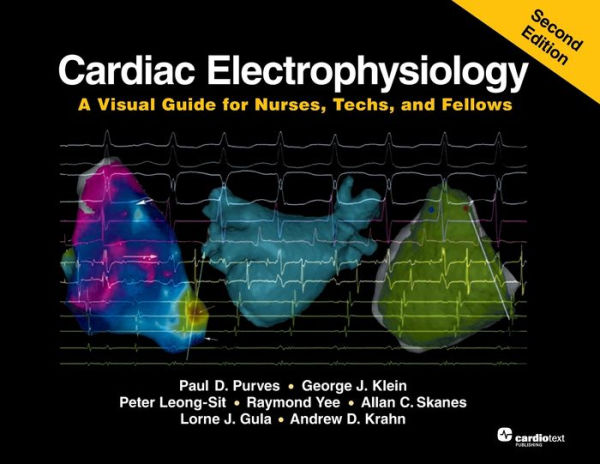 Cardiac Electrophysiology: A Visual Guide for Nurses, Techs, and Fellows, Second Edition