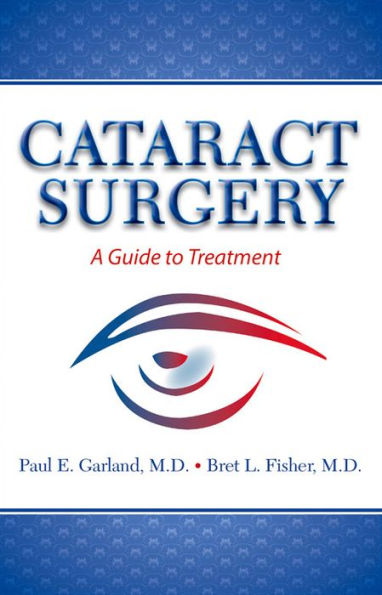 Cataract Surgery: A Guide to Treatment