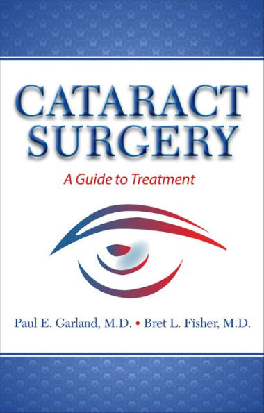 Cataract Surgery: A Guide to Treatment