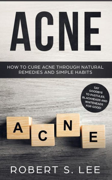 Acne: How to Cure Acne through Natural Remedies and Simple Habits. Say Goodbye Pustules, Blackheads Whiteheads for Good!