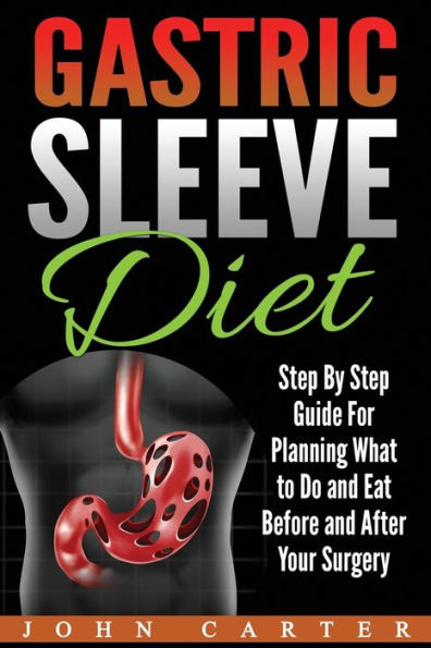 Gastric Sleeve Diet: Step By Guide For Planning What to Do and Eat Before After Your Surgery