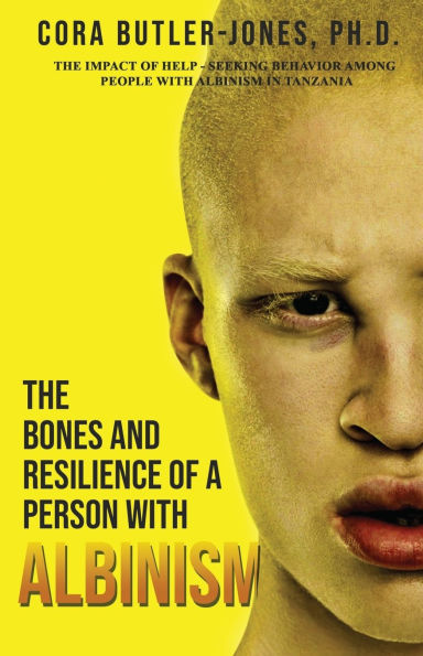 The Bones and Resilience of a Person with Albinism