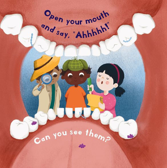 Where Do the Sugar Bugs Hide?