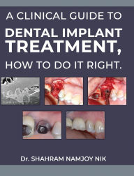 Title: A guide to dental implant treatment, how to do it right., Author: Shahram Namjoy