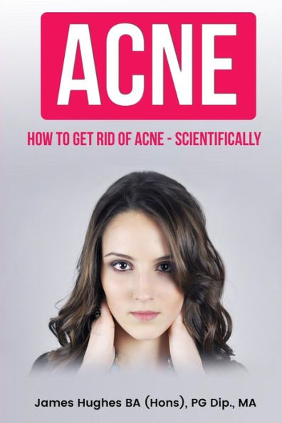 Acne: How to get rid of acne - scientifically