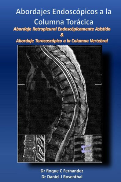 Abordajes Endoscopicos a la Columna Toracica: Abordaje retropleural endoscopicamente asistido & Abordaje toracoscopico a la columna vertebral