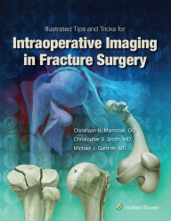 Title: Illustrated Tips and Tricks for Intraoperative Imaging in Fracture Surgery, Author: Michael J. Gardner