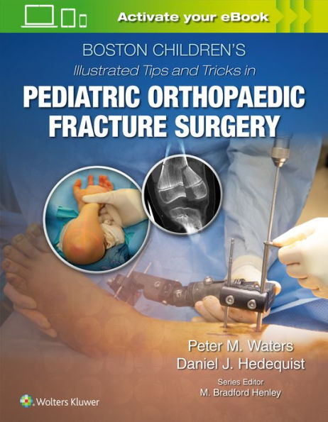 Boston Children's Illustrated Tips and Tricks Pediatric Orthopaedic Fracture Surgery