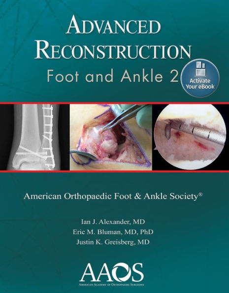 Advanced Reconstruction: Foot and Ankle 2: Print + Ebook / Edition 2