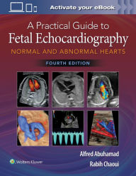 Free audiobooks to download uk A Practical Guide to Fetal Echocardiography: Normal and Abnormal Hearts CHM by  9781975126810 in English