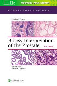 Title: Biopsy Interpretation of the Prostate / Edition 6, Author: Jonathan I. Epstein