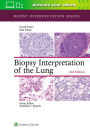 Biopsy Interpretation of the Lung / Edition 2