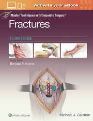 Master Techniques in Orthopaedic Surgery: Fractures / Edition 4