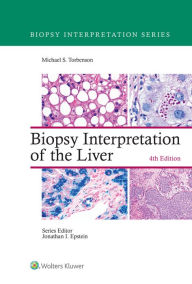 Title: Biopsy Interpretation of the Liver, Author: Michael Torbenson