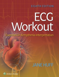 Title: ECG Workout: Exercises in Arrhythmia Interpretation, Author: LOREDA J. HUFF
