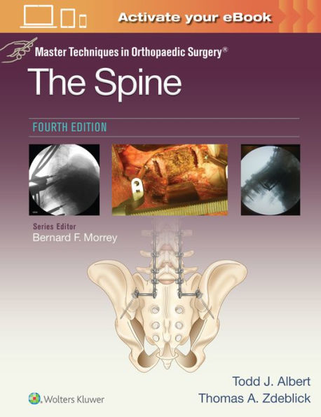 Master Techniques Orthopaedic Surgery: The Spine