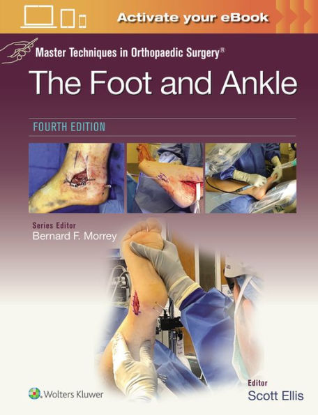 Master Techniques Orthopaedic Surgery: The Foot and Ankle: Print + eBook with Multimedia
