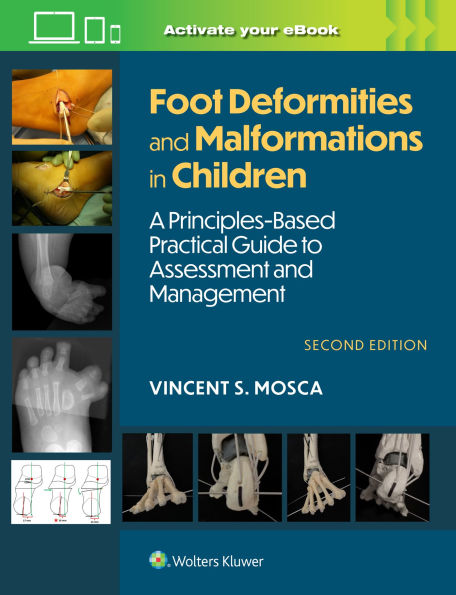 Foot Deformities and Malformations Children: A Principles-Based, Practical Guide to Assessment Management: Print + eBook with Multimedia