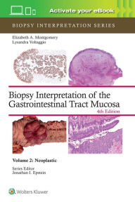 Title: Biopsy Interpretation of the Gastrointestinal Tract Mucosa Volume 2: Neoplastic: Print + eBook with Multimedia, Author: ELIZABETH ANNE MONTGOMERY
