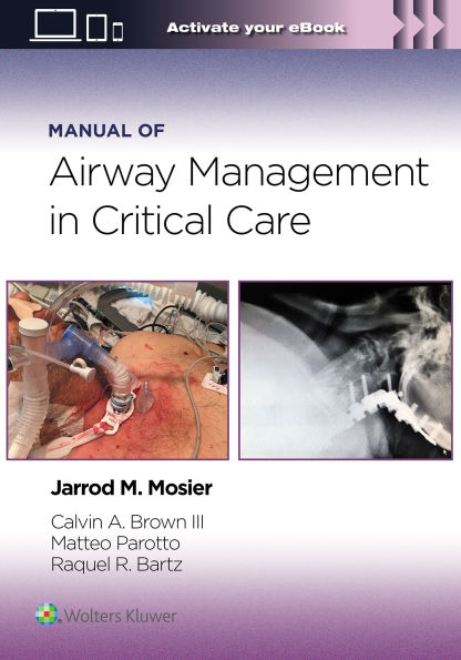 Manual of Airway Management Critical Care: Print + eBook with Multimedia