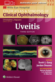 Title: Uveitis, Author: Sunir J Garg