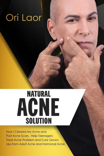 Natural Acne Solution: How I Cleared My Acne and Post Acne Scars. Help Teenagers Treat Acne Problem and Cure Grown Ups from Adult Acne and Hormonal Acne