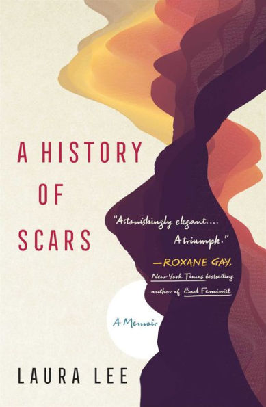 A History of Scars: Memoir