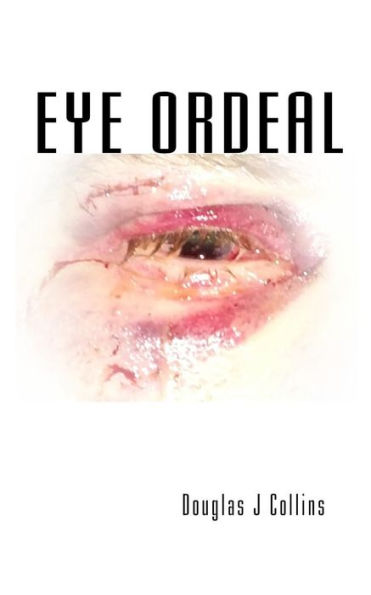 Eye Ordeal