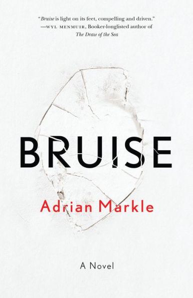 Bruise: A Novel