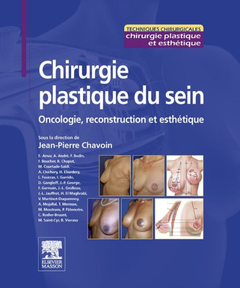 Chirurgie plastique du sein: Oncologie, reconstruction et esthétique