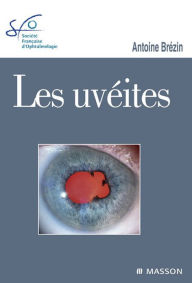 Title: Les uvéites: Rapport SFO 2010, Author: Antoine Brézin
