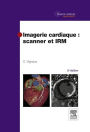 Imagerie cardiaque : scanner et IRM