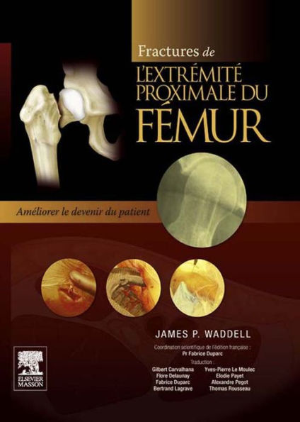 Fractures de l'extrémité proximale du fémur: Améliorer le devenir du patient