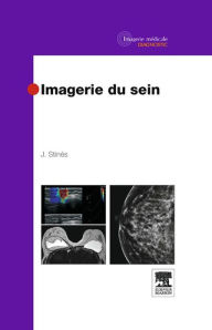 Title: Imagerie du sein, Author: Joseph Stinès