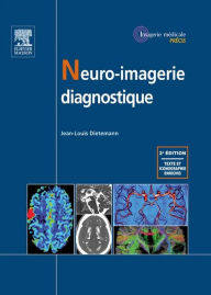 Title: Neuro-imagerie diagnostique, Author: Jean-Louis Dietemann