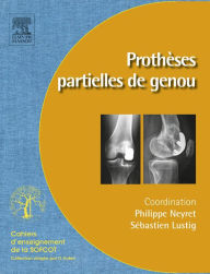 Title: Prothèses partielles du genou: Prothèses unicompartimentaires et fémoropatellaires, Author: Philippe Neyret