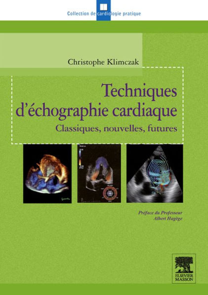 Techniques d'échographie cardiaque: Classiques, nouvelles, futures