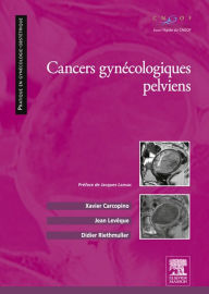 Title: Cancers gynécologiques pelviens, Author: Xavier Carcopino