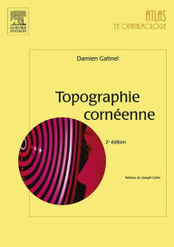 Title: Topographie cornéenne, Author: Damien Gatinel MD