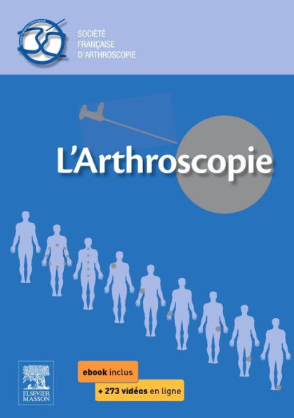 L'arthroscopie