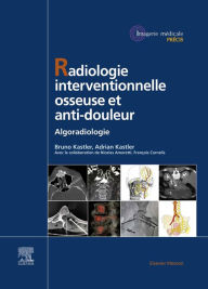 Title: Radiologie Interventionnelle osseuse et anti-douleur: Algoradiologie, Author: Bruno Kastler